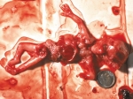 aborted baby 2