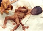 aborted baby 4